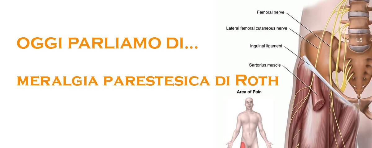 Cos'è la meralgia parestesica di Roth e come è possibile trattarla?